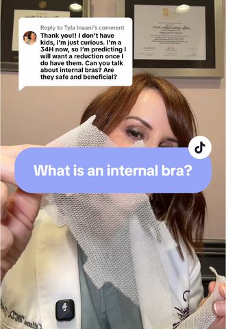 What Is an Internal Bra? (And Why I Use Surgical Scaffolding)
