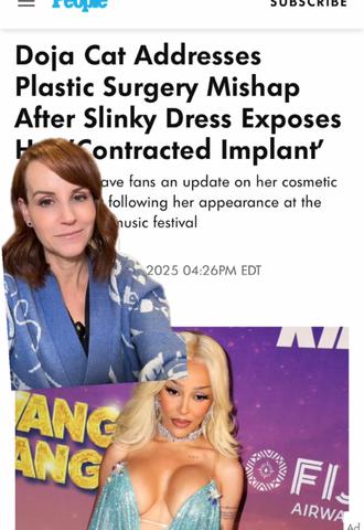 Doja Cat's Capsular Contracture: Let's Talk About It (Kindly)