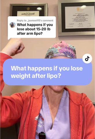 What Happens If You Lose Weight After Liposuction?