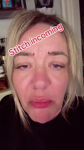 Please Do Not Inject Your Own Botox at Home