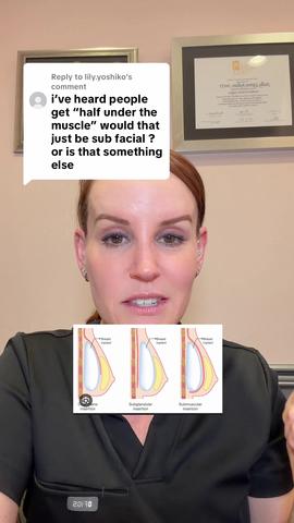 Subglandular, Submuscular, Dual Plane, Subfascial — Implant Placements Explained