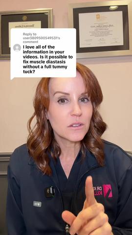 Can You Fix a Diastasis Without a Tummy Tuck?