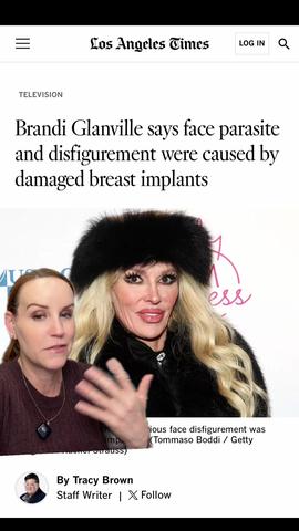 Can Breast Implants Cause a Facial Parasite? A Surgeon's Response